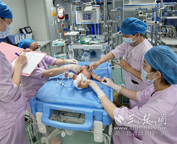 新生儿科医护人员紧急为患儿进行换血治疗.jpg