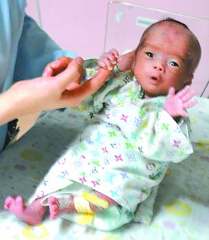 出生时体重仅900克的“袖珍妹妹”语语目前各项生命体征已平稳。 记者 蒋雨龙 摄